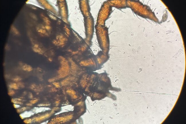 マダニ！※写真閲覧注意